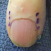 التخطيط الجراحي الدقيق قبل بدء العملية