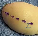 متابعة حالة مريض بعد التعافي الكامل في العيادة