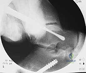 مناقشة الخيارات الجراحية مع المريض في عيادة د. هطيف