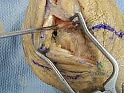 الفحص السريري الدقيق للكاحل مع الدكتور محمد هطيف