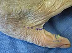 التشخيص السريري لالتهابات اليد