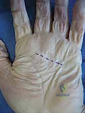 التصوير الطبي لتشخيص التهابات اليد