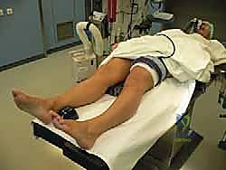 توضيح طبي: استخراج وتر العضلة الأخمصية (Plantaris Tendon) لاستخدامه كرقعة ذاتية