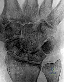 التخطيط الجراحي الدقيق مع الأستاذ الدكتور محمد هطيف