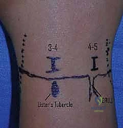 إجراءات التشخيص والفحص السريري