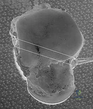 استخدام تقنيات المنظار والجراحة الميكروسكوبية