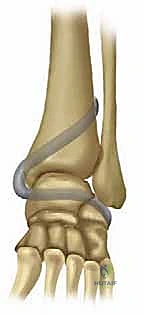 الأربطة العميقة والسطحية في مفصل الكاحل