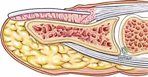 تفاصيل دقيقة لسرير الظفر والمصفوفة