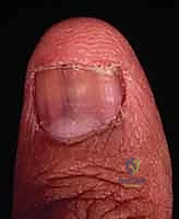 تنظيف وتجهيز سرير الظفر