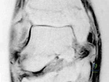 استخدام المنظار الجراحي