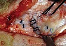 التأكد من متانة الرباط