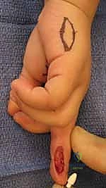 استخدام الأشعة السينية في التشخيص