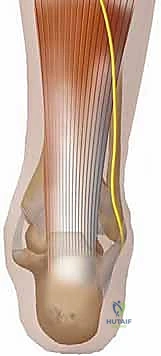 صورة توضيحية: الفحص السريري للقدم والكاحل لتشخيص تمزق وتر أخيل