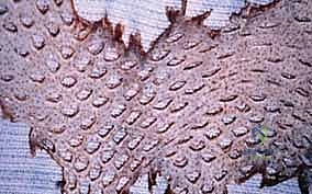 التحضير لعملية الترقيع الجلدي