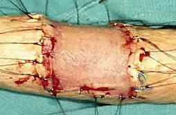 خبرة الأستاذ الدكتور محمد هطيف