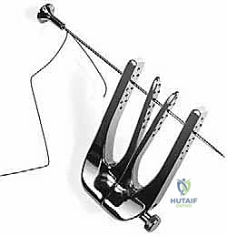 صورة توضيحية لـ إصلاح تمزق وتر أخيل المحدود بالمنظار