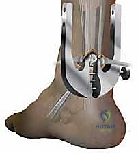 إصلاح تمزق وتر أخيل المحدود بالمنظار: دليل شامل من الأستاذ الدكتور محمد هطيف في صنعاء