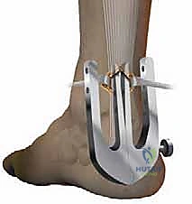 تجهيز المريض وغرفة العمليات في عيادة الدكتور هطيف