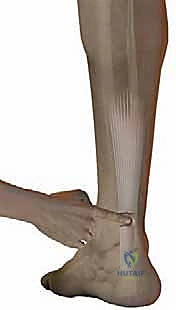 مقارنة بين خيارات العلاج الجراحي وغير الجراحي