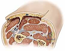 التأكد من التروية الدموية قبل القطع