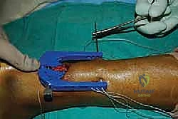 الفحص السريري الدقيق