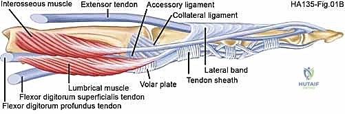 تقييم حالة تيبس شديد في أصابع اليد قبل الجراحة