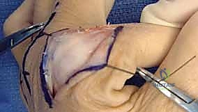 الفحص السريري الدقيق لمفاصل اليد مع د. هطيف