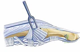 صورة توضيحية لـ علاج تقلصات مفاصل اليد (MCP و PIP): استعادة مرونة أصابعك مع الأستاذ الدكتور محمد هطيف في صنعاء