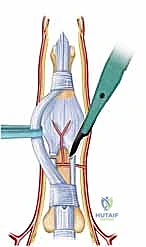 الاعتماد على التقنيات الحديثة في غرف العمليات