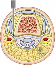 التخطيط الجراحي الدقيق قبل العملية