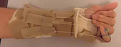 تجهيز المريض وتطبيق التخدير الموضعي للذراع