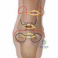 تشخيص تمزق وتر أخيل والاختبارات السريرية