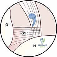 التجهيز للجراحة
