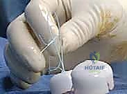 صورة توضيحية لـ إصلاح وتر تحت الكتف بالمنظار في صنعاء: دليل شامل من الأستاذ الدكتور محمد هطيف