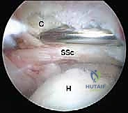 الميكانيكا الحيوية لحركة الكتف