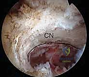 مقارنة خيارات العلاج