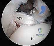 الأستاذ الدكتور محمد هطيف أثناء الجراحة