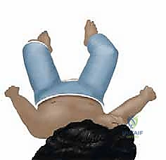 الشفاء التام لكسر الفخذ عند الأطفال