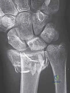 استخدام الأشعة السينية والمقطعية في التشخيص