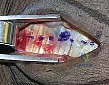 تجهيز المريض والتخدير