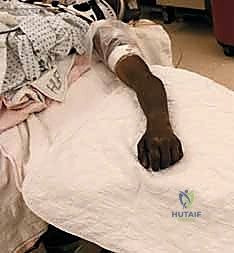 تحضير الشريحة الجراحية