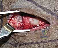 أنواع الشرائح الظهرية المستخدمة