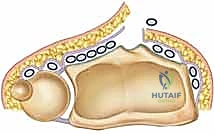 آلية السقوط وتأثيرها على الكعبرة