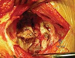 تجهيز المريض والتخطيط الجراحي