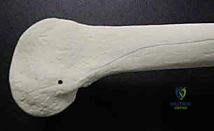 دراسة زوايا مفصل الركبة