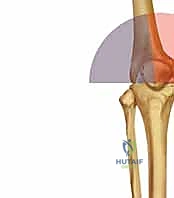تقييم حالة الكسر قبل الجراحة