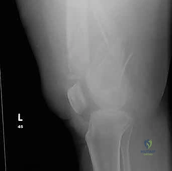 المحاور التشريحية الدقيقة
