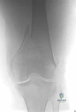 تخطيط ثلاثي الأبعاد