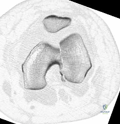 تحديد العلامات التشريحية على الجلد