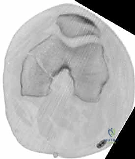 استخدام جهاز الأشعة C-Arm